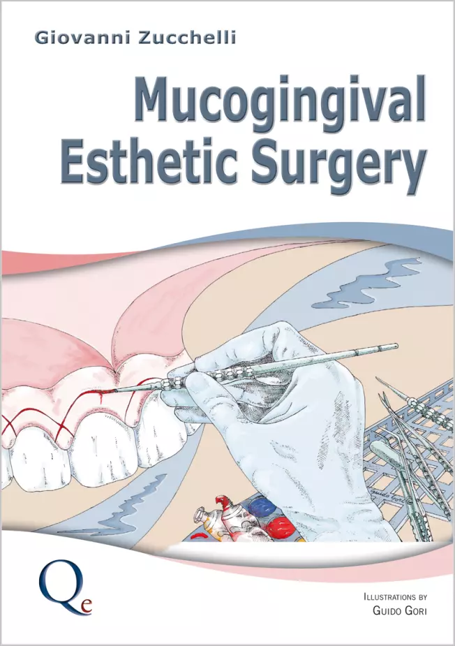 Mucogingival Esthetic Surgery - Pdf